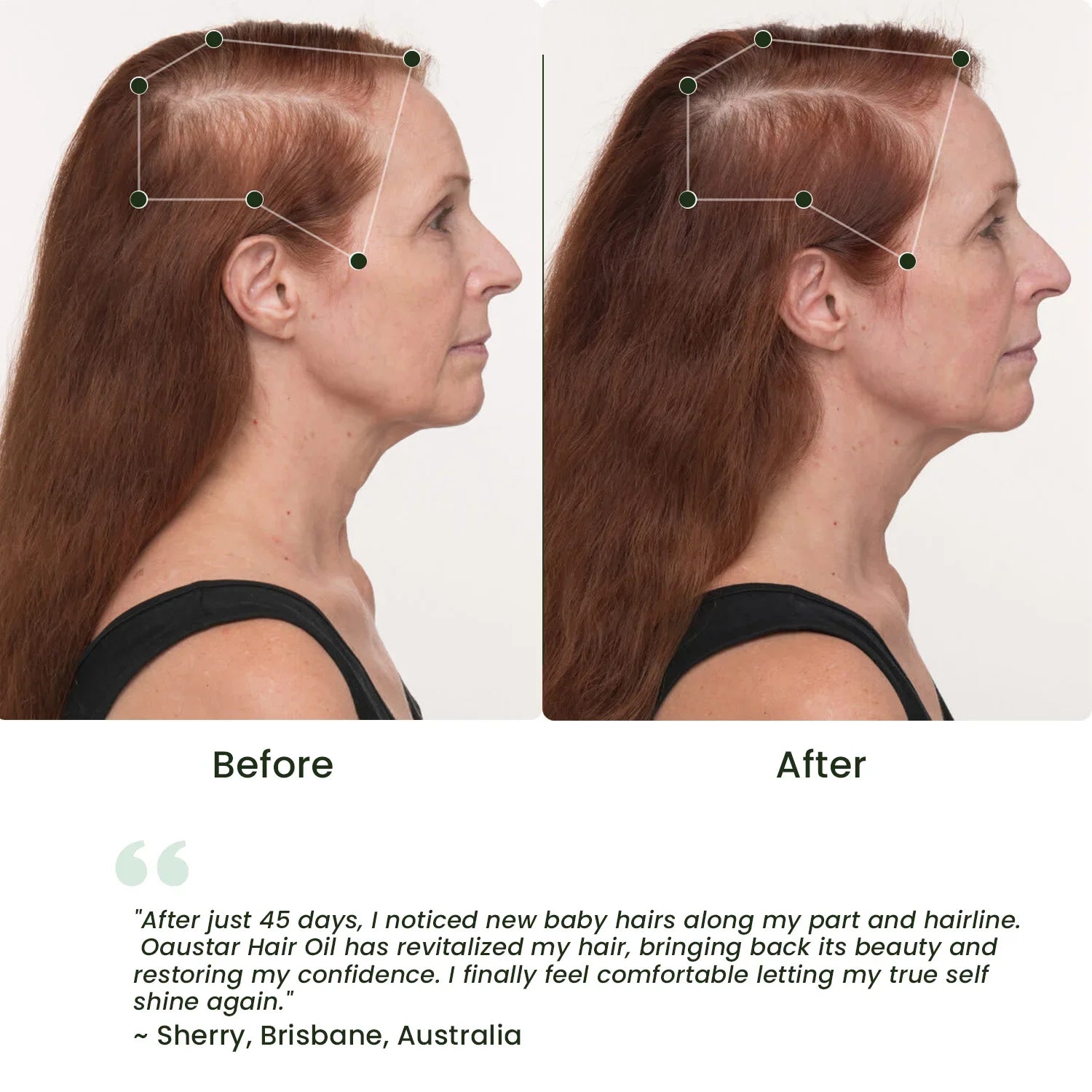 Best Organic Hair Oil For Dry & Damaged Hair [Hair Growth Oil]