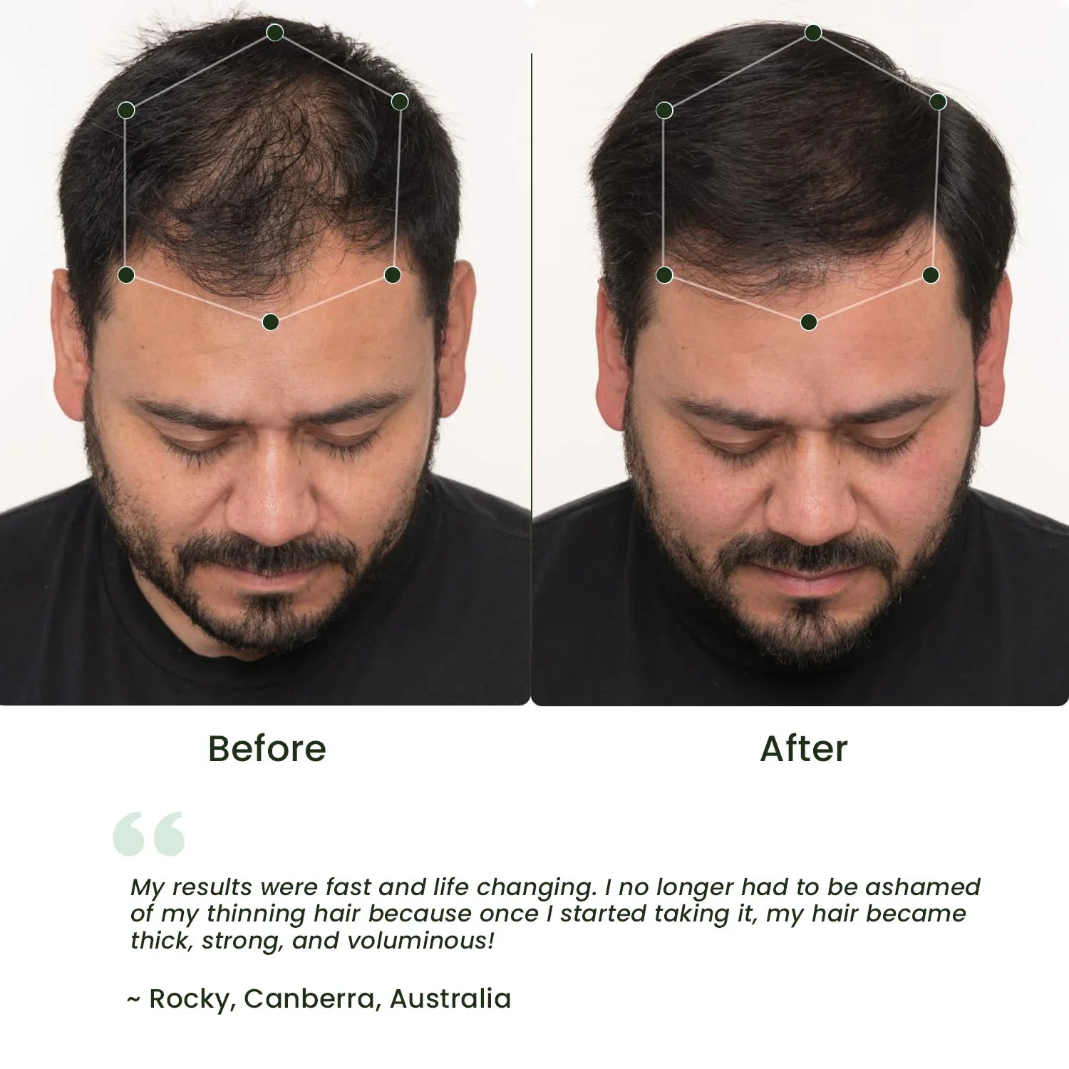 Castor Oil for Eyelashes, Eyebrows & Hair [100% Organic]