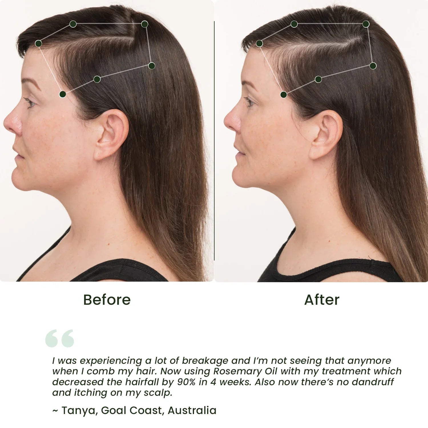 Organic Rosemary Hair Growth Oil for Dry & Damaged Hair