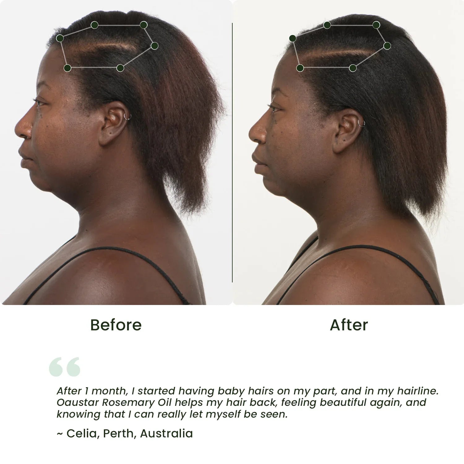 Organic Rosemary Hair Growth Oil for Dry & Damaged Hair